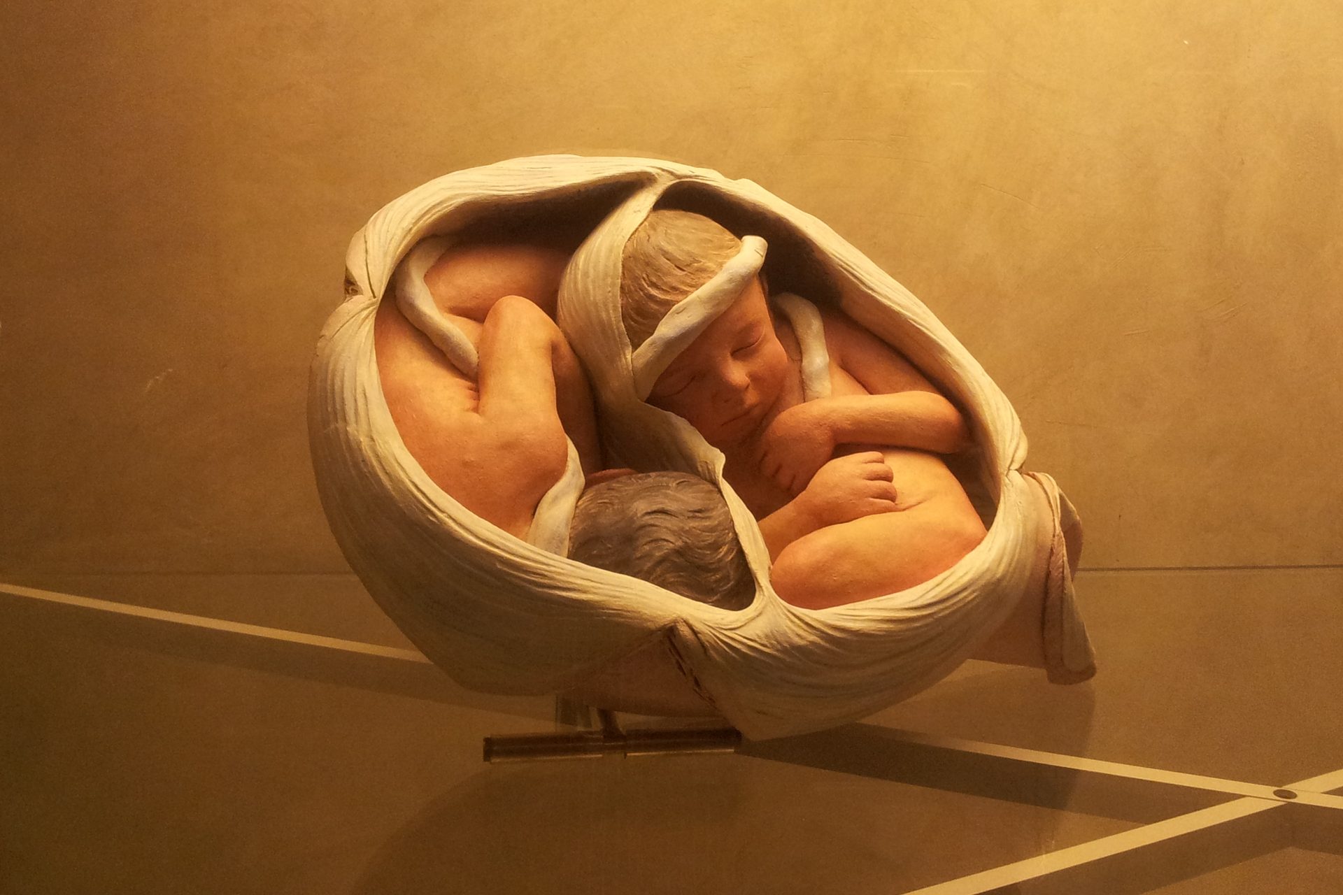 Uterus in 9th month of pregnancy with twins (terracotta), Bologna (2).jpg